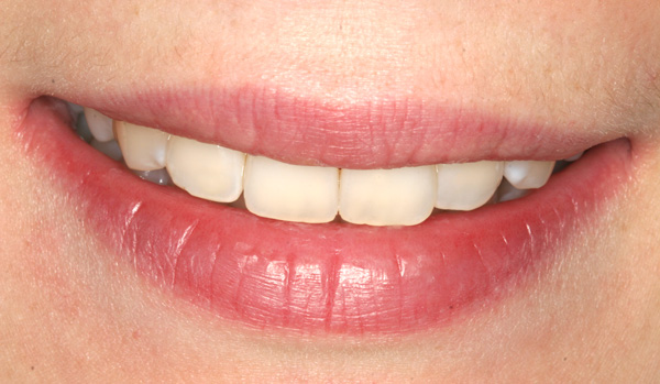 smile-of-the-day-w