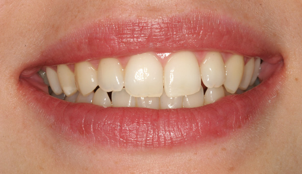 smile-of-the-day-w8