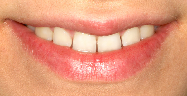 smile