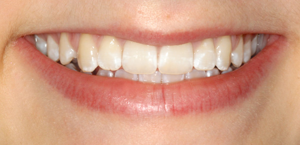 smile1
