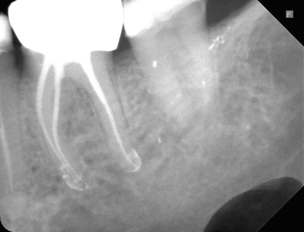 Endorevision-36-w1