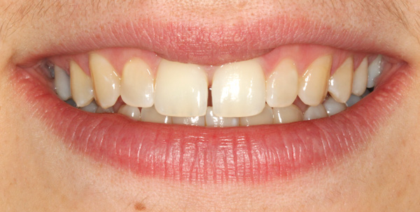 smile1
