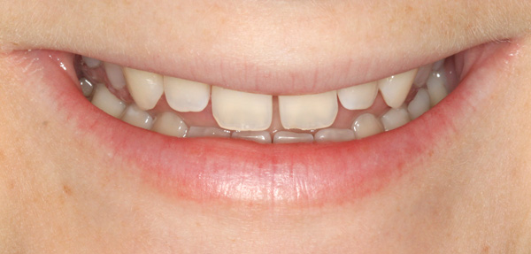 smile-1
