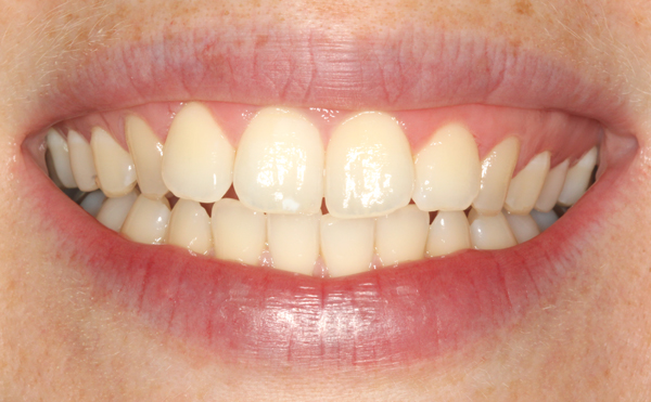 smile2
