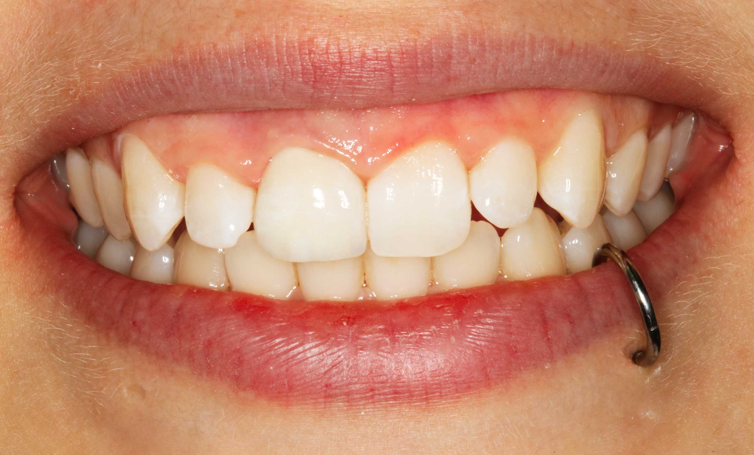 smile1b