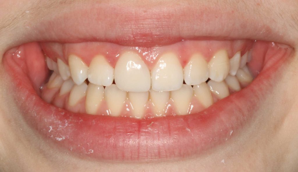 ästhetische Zahnheilkunde Zahnnotizen